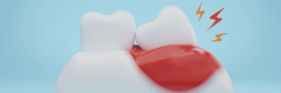 periodontal disease treatment phoenix