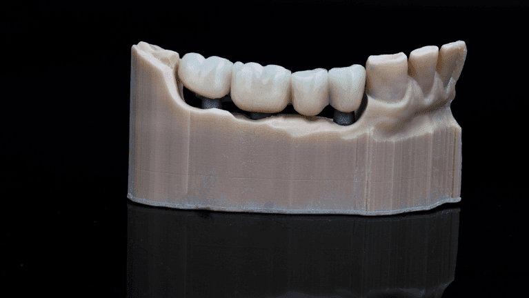 Tooth structure model in Phoenix
