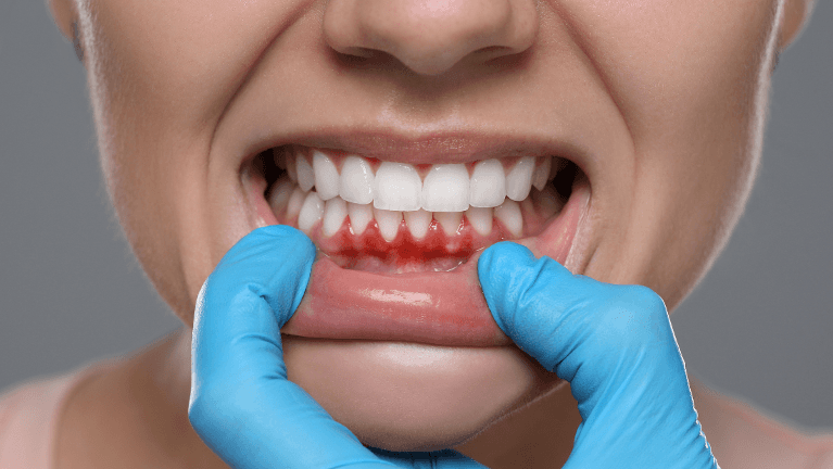 gum disease treatment phoenix