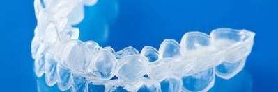 clear aligners