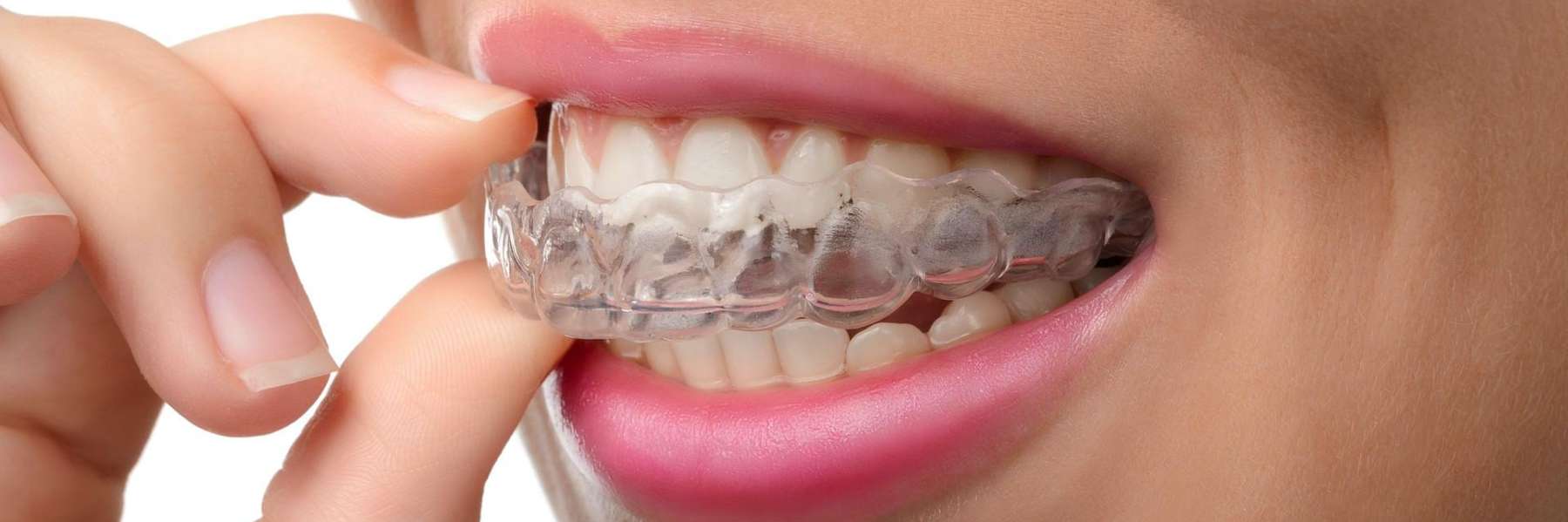 woman wearing Invisalign | orthodontic treatment in Phoenix